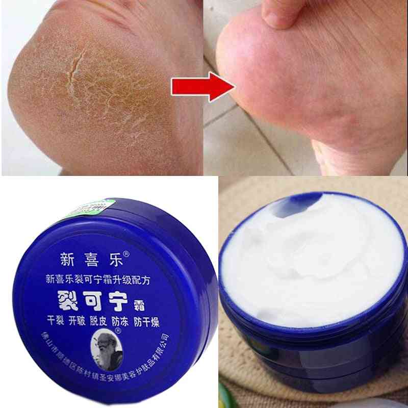 Traditioneel - olie tegen uitdroging van dode huidcrème om gebarsten voet in de hiel