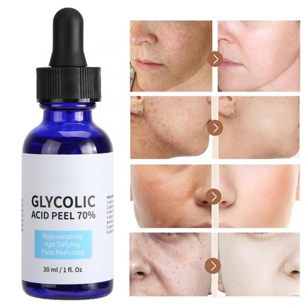 Glycolic Acid Peel Repair Solution - Shrink Pores Brighten Skin, Improve Acne