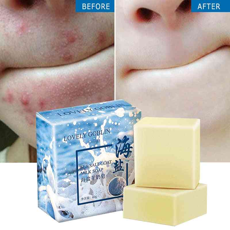 Sea Salt Soap- Face Wash And Skin Care