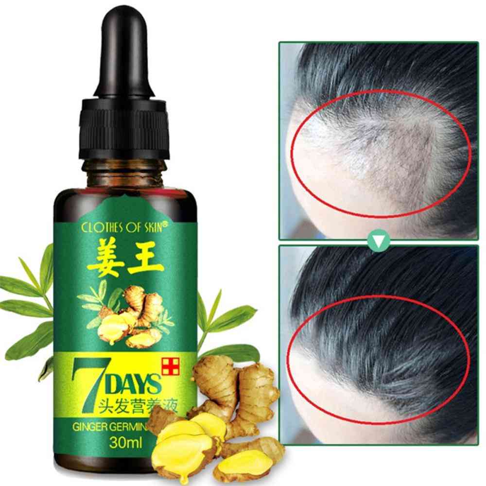 Ginger Hair Growth Essence - Germinal Hair Growth Serum Essence Oil