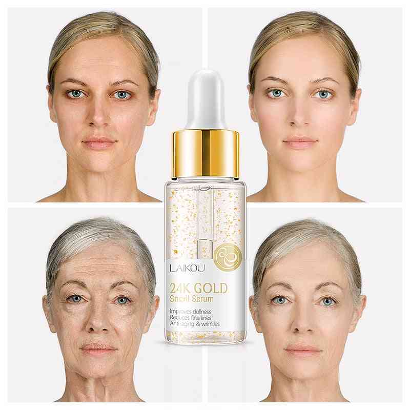 Hydraterende gezichtscrème whitening hydrateren - slak serum anti rimpel, anti veroudering gezicht krimpen de poriën gezicht huidverzorging -