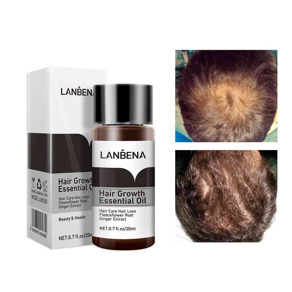 Hair Growth Essence Oil Treatment - Preventing Hair Loss Care
