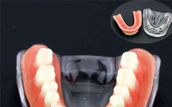 модел на зъби за надзъбни зъби със златна лента-зъболекарско обучение и проучване