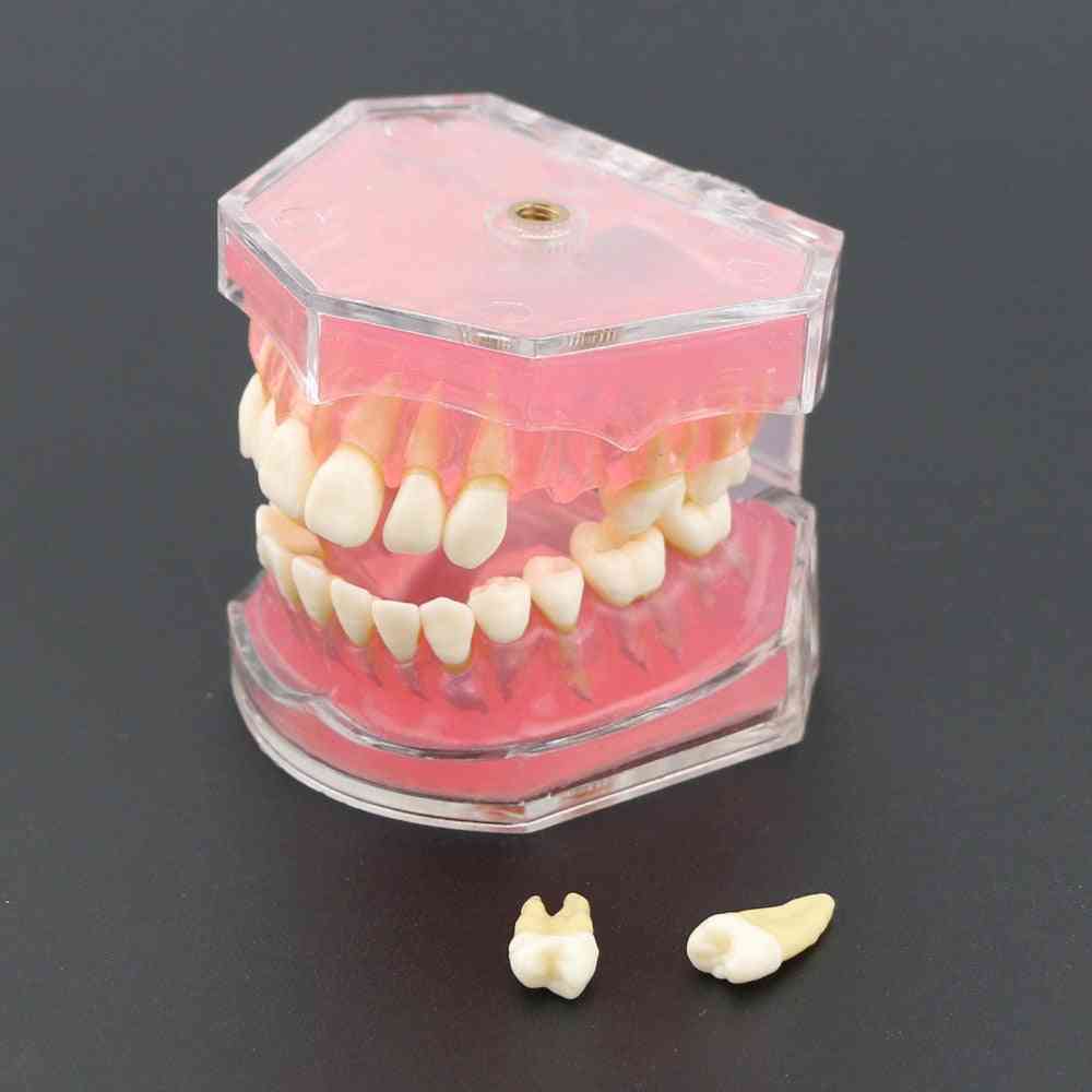 Dental Standard Model With Removable Teeth For Dental Study