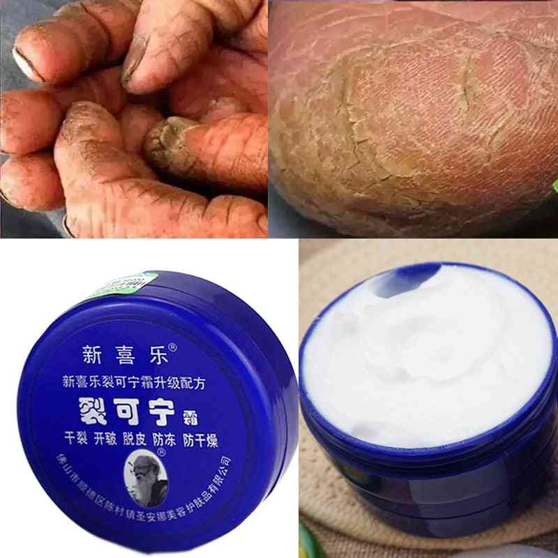 Tradičná čínska kozmetika krém na masáž päty nôh, suchý, popraskaný