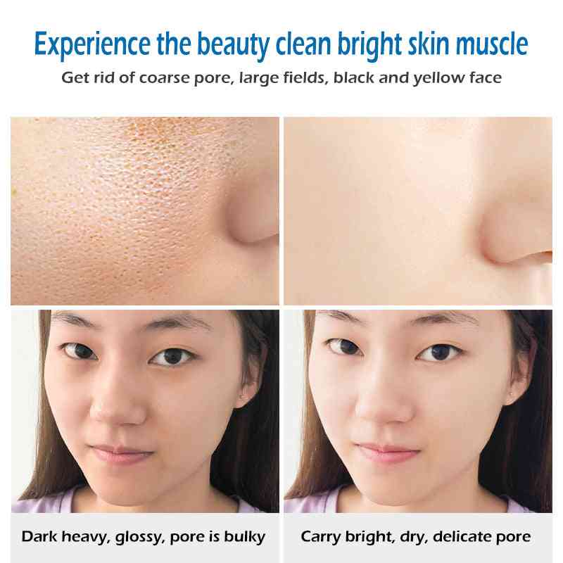 Face Soap Whitening Moisturizing - Remove Pimple Pores , Acne Treatment For Face Care