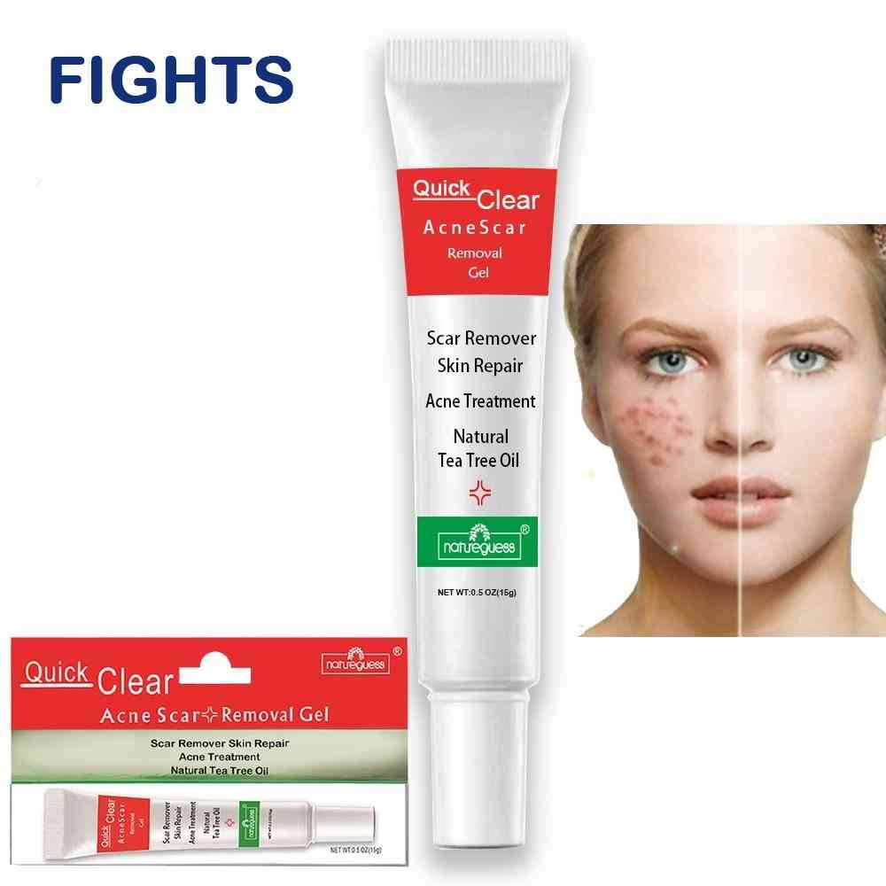 Gesichtscreme zur Behandlung von Akne