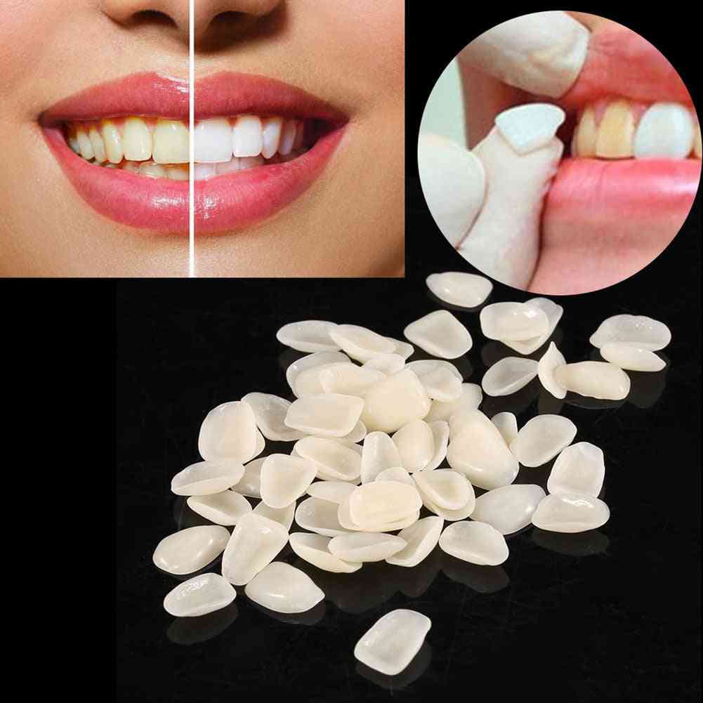 Dental Ultrathin- Composite Resin Veneers, Upper Anterior Teeth Restorative