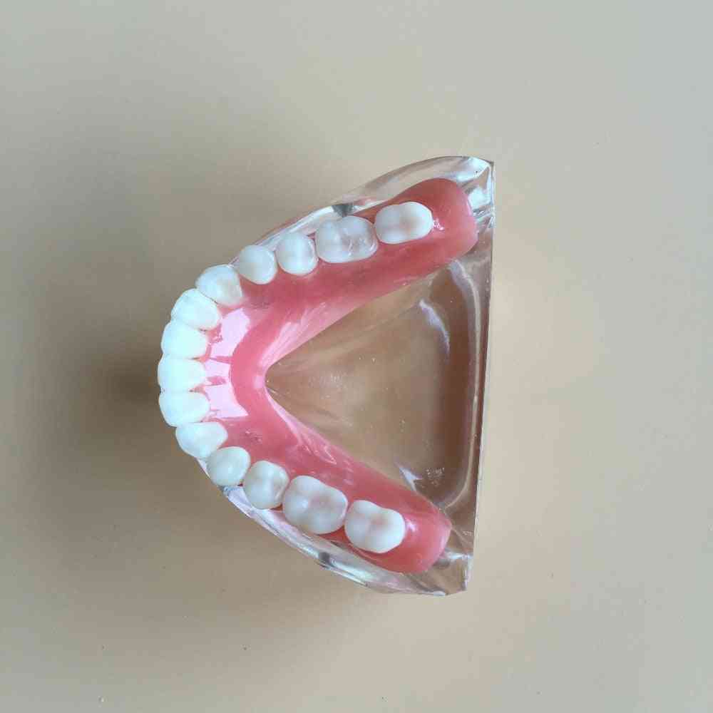 Removable Interior Mandibular Dental Teeth