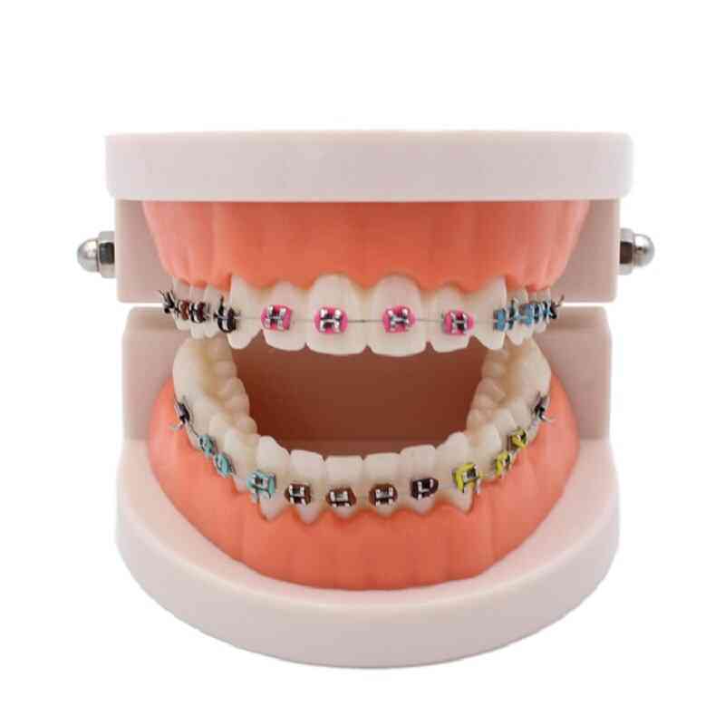 Dental Orthodontic Treatment Teeth Model