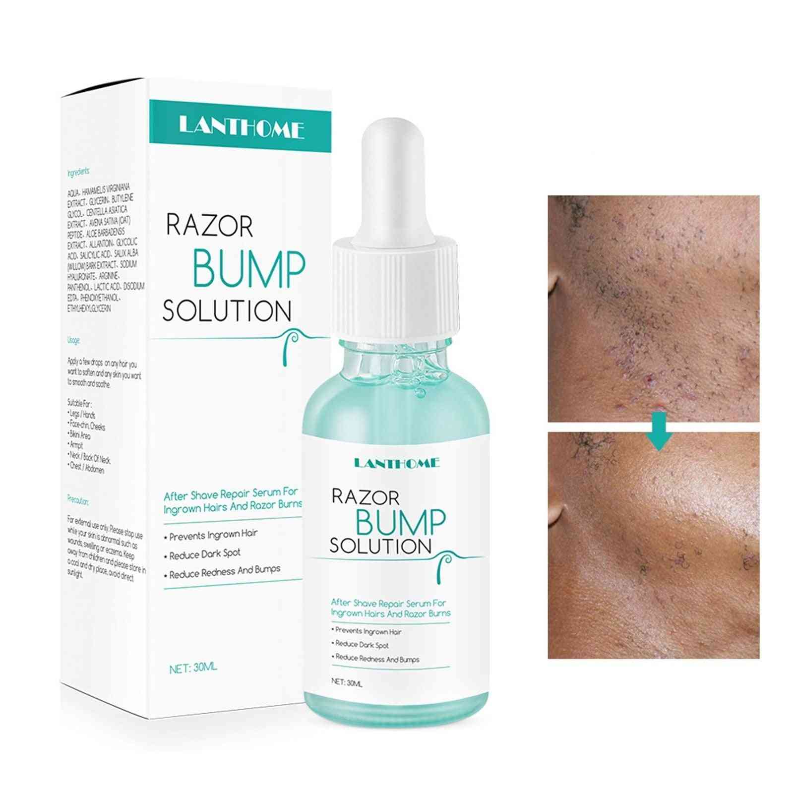Bump Stopper- Ingrown Reduce Redness, Smooth Repair Skin Hair, Mild Serum