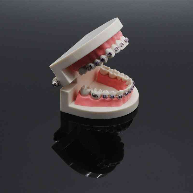 Dentistry Lab Teach Study Standard Typodont Demonstration Teeth Model With Bracket