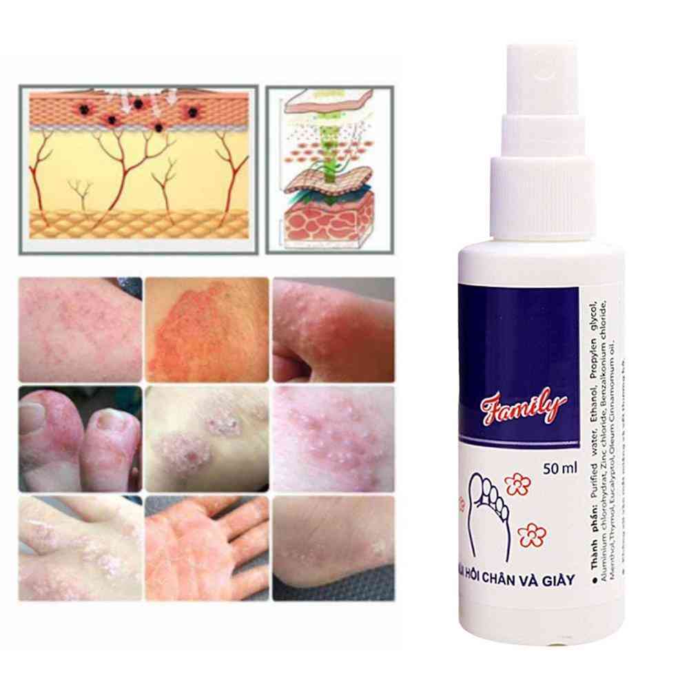 Vietnam Refreshing Antiperspirant Foot Fresh Spray