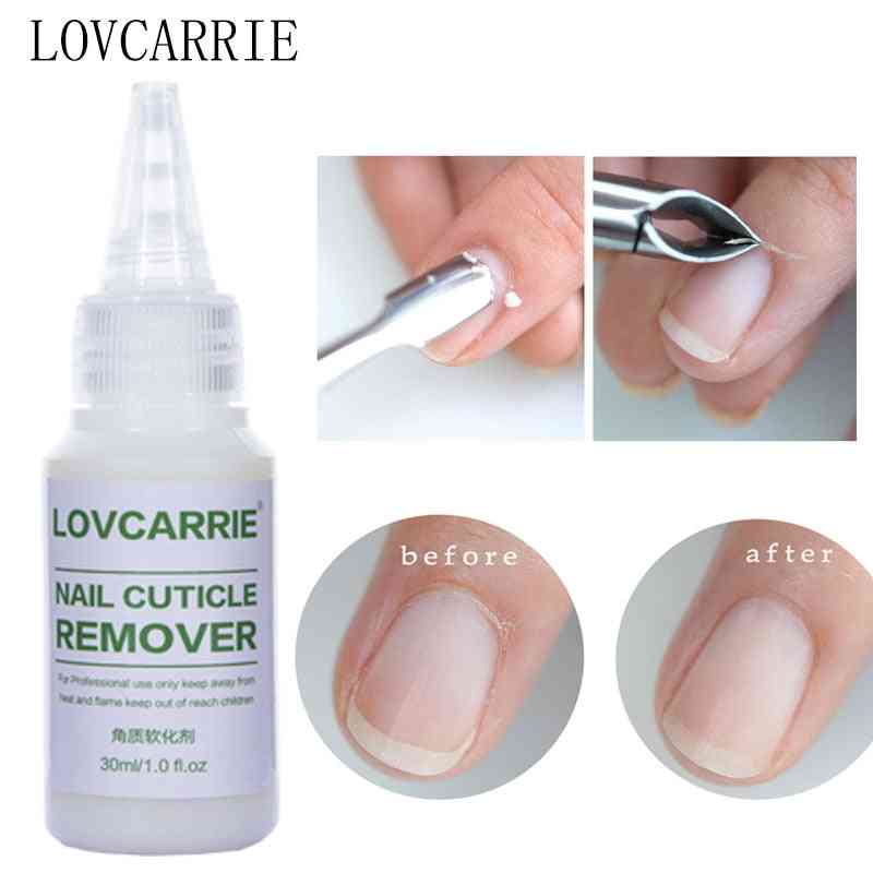 Nail Cuticle Remover Gel