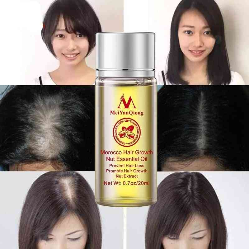 Hair Loss Products Essence Liquid Treatment