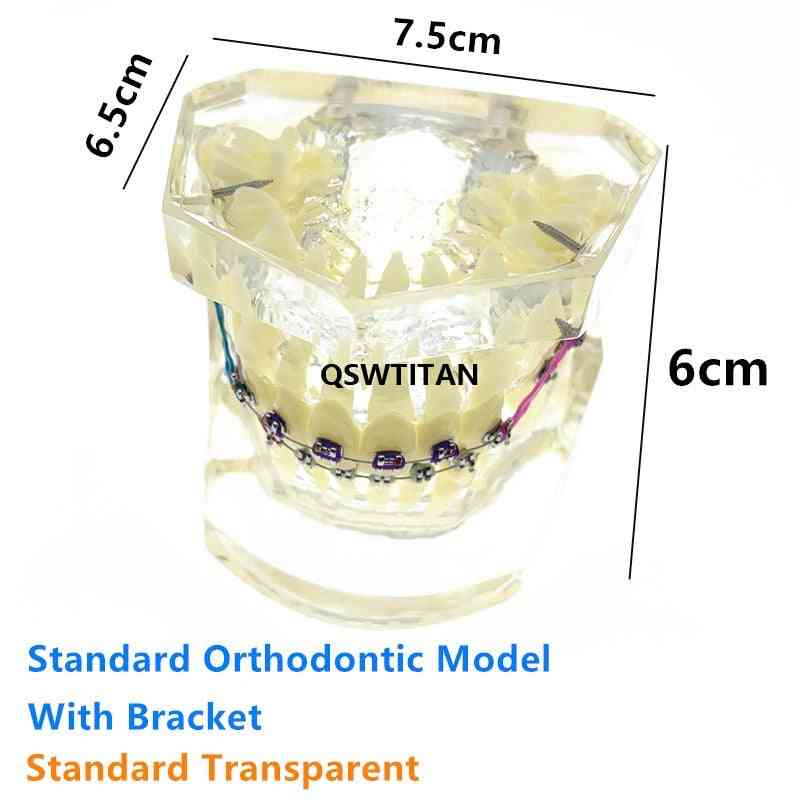 Dental Orthodontic Teeth Malocclusion Orthodontic Model With Brackets